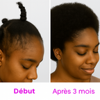 Huile capillaire EXTREM' POUSSE 30 ml